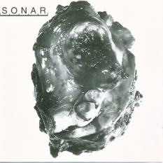 Sonar