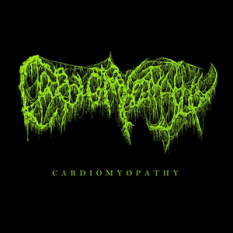 Cardiomyopathy