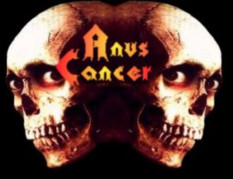 Anus Cancer