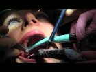4-Handed Aspiration Demo - Dynamic Dentistry