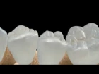 Регенерация зубов / Tooth Regeneration