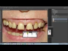 Digital Smile Design по-русски - часть 2