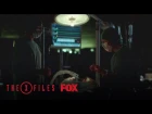 Doctors Open A Patients Body | Season 11 Ep. 9 | THE X-FILES